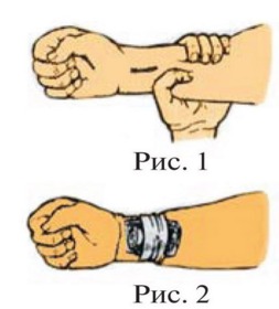 На каком рисунке наиболее правильно показан метод остановки кровотечения из раны?