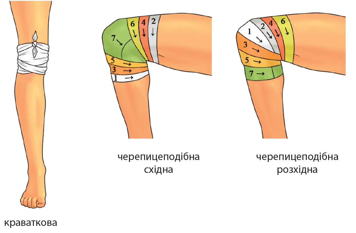 Повязки на колено Повязки на колено