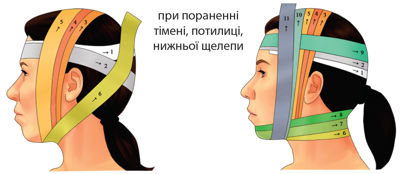 Пов'язки на частини голови</ Пов'язки на частини голови</