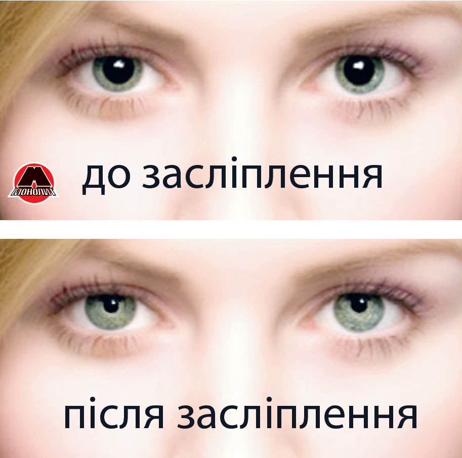 Последствия ослепления